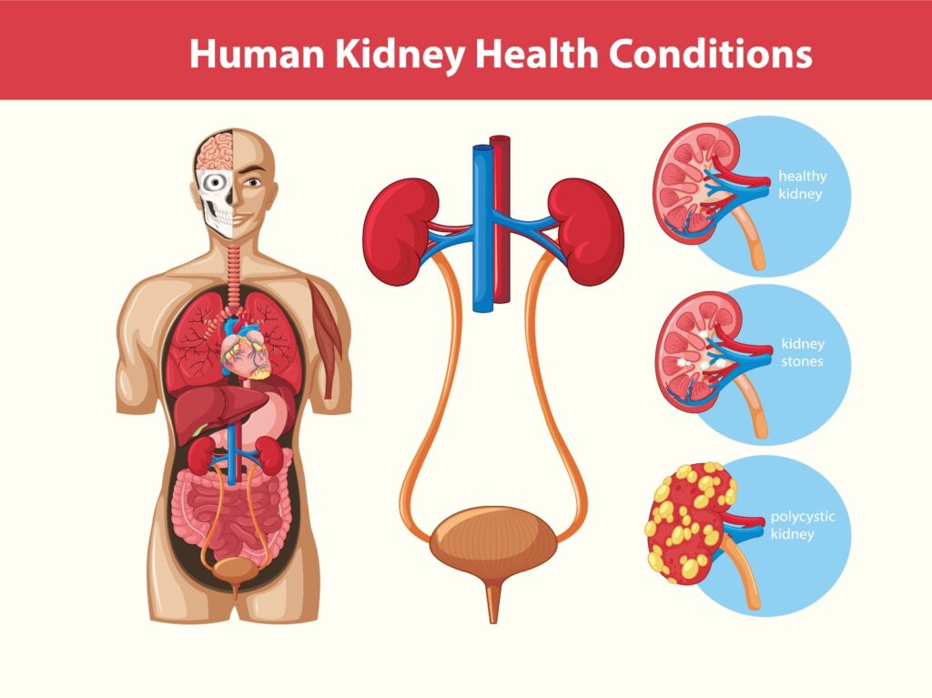 HOW TO MAKE KIDNEY HEALTH A PRIORITY | Neogen Home Health
